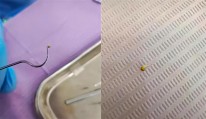 草莓种子的发芽方法 草莓苗同时长出两片新叶