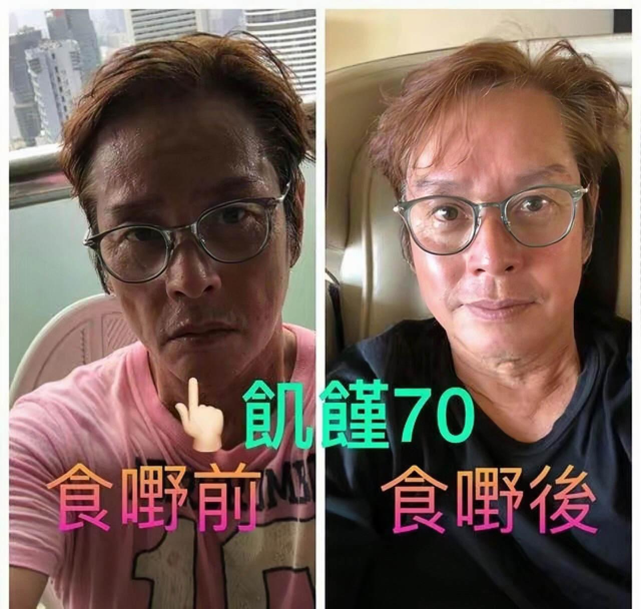 香港知名男星被质疑患糖尿病，近照腿细肚子大，像怀孕5个月